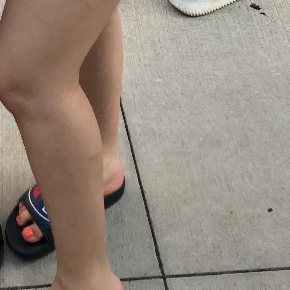 Champion slides